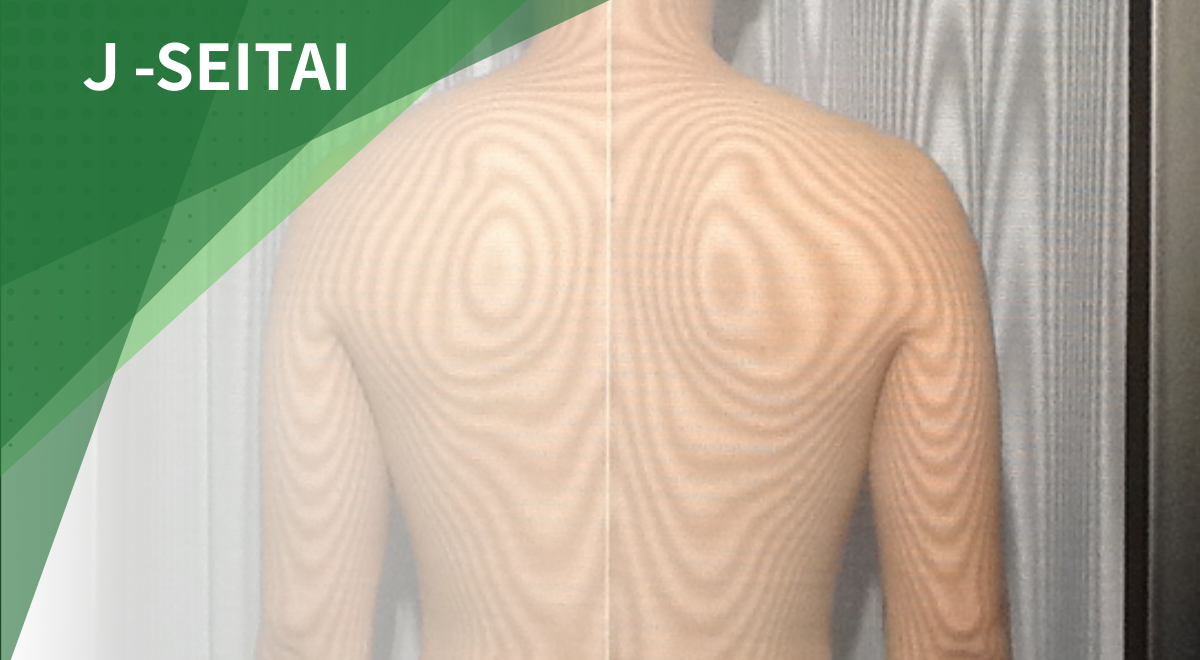 J-SEITAI施術前に背骨や姿勢の歪みを確認するモアレグラフィー検査